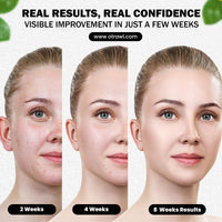 Skin Whitening Vitamin C Face Serum